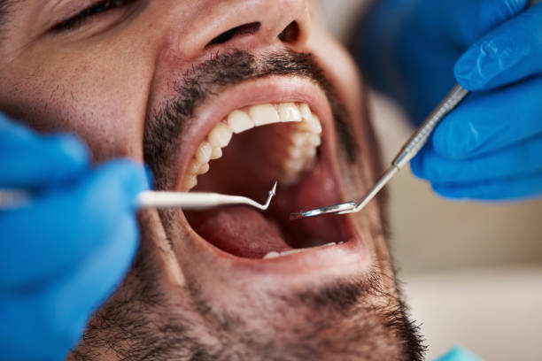 Best Emergency Broken Tooth Repair in Ojai, CA